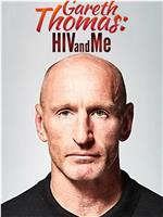 加雷斯·托马斯：HIV与我